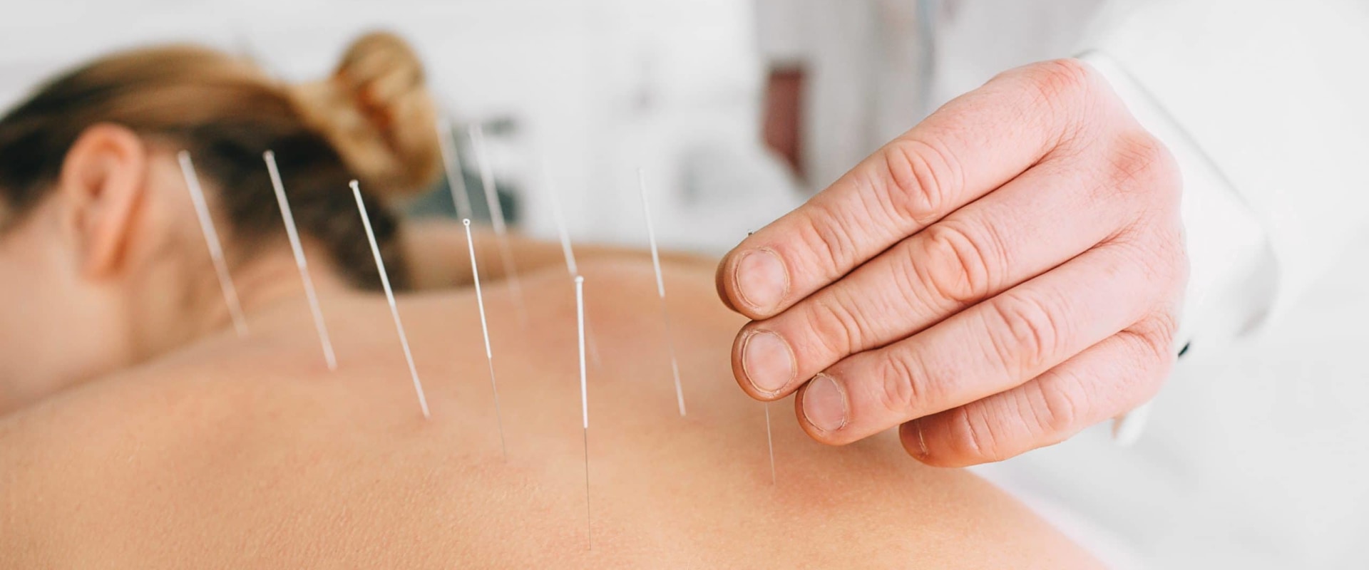 Can Acupuncture Help Addiction? A Comprehensive Guide