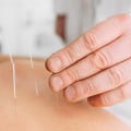 How does acupuncture help recovery?
