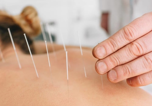 Can acupuncture help addiction?